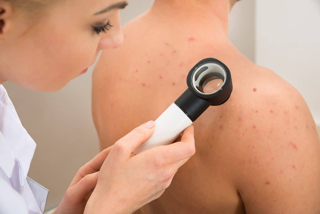 Diagnosis and Seminar Treatment of various Skin Diseases