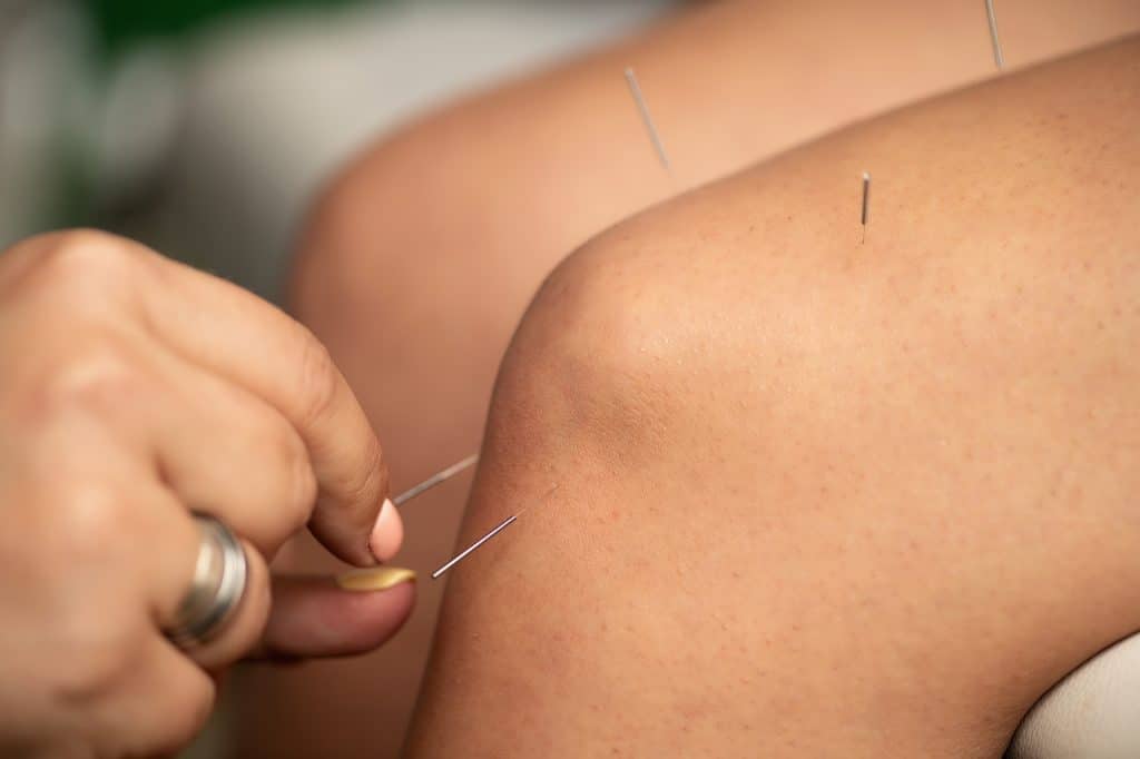 Acupuncture Treatment for Chronic Musculoskeletal Pain