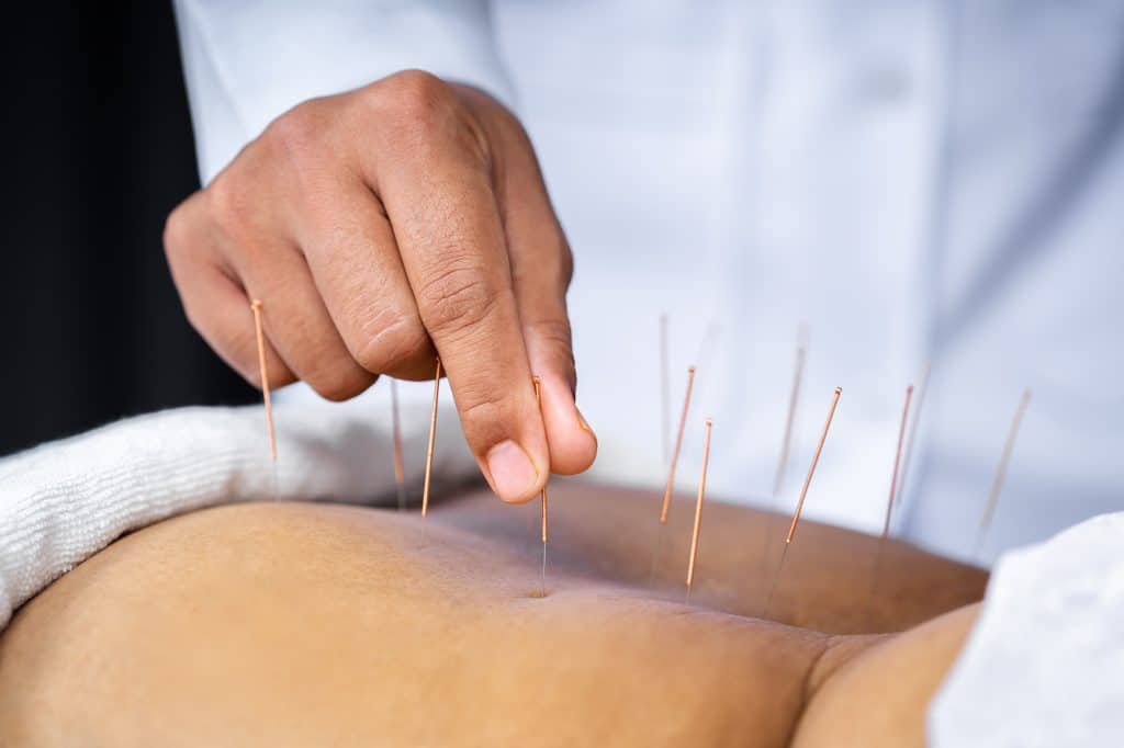 Acupuncture Treatment for Chronic Musculoskeletal Pain